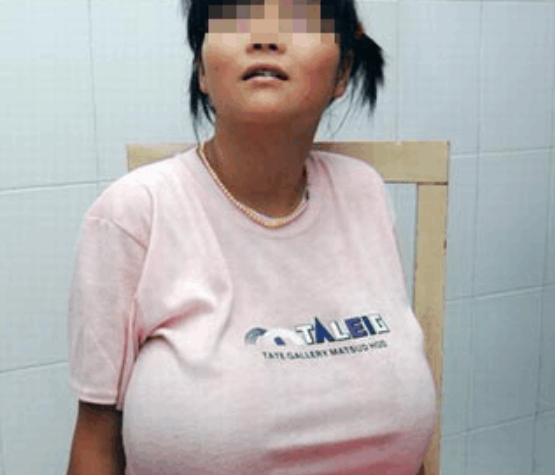 13岁同学胸部大的异常,嘲笑女生受尽,手术过后女孩老实人图片