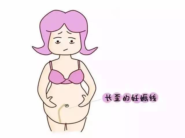 90%的女性在怀孕后,肚子上都会出现这条"神秘"的竖线,它穿越肚脐,把