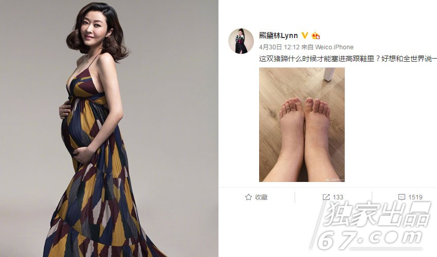 明星妈妈孕产真不易!熊黛林患妈妈手缠绷带 大s怀三胎发福丢代言