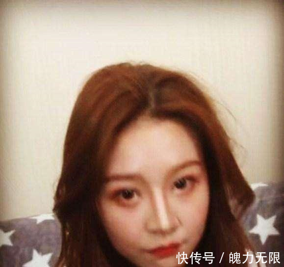 韩国v女生美女生距离整容,樱桃嘴转变香肠嘴,网保持你失败少女与刻意图片