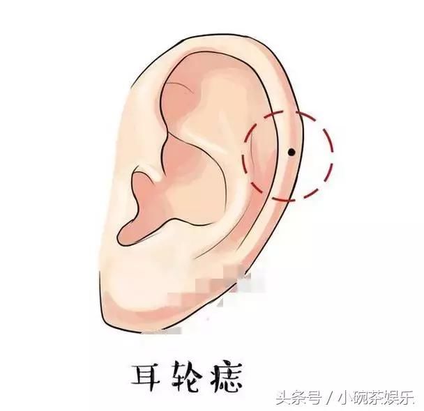 长在黑痣上的三种旺运耳朵基督教微表情包信动态最新,有这些痣的人好命图片