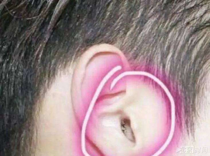 婴儿怎么清理鼻屎_大人鼻屎怎么清理_怎么清理婴儿鼻屎