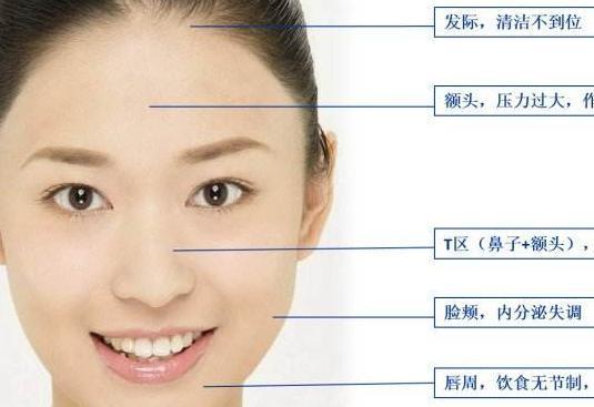 不同位置的痘痘反射五脏六腑的病症?长痘痘平时生活要