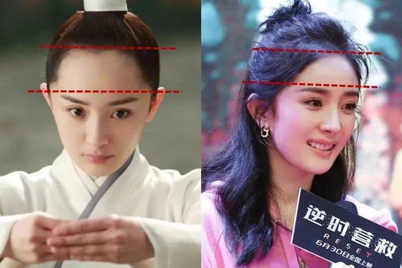 对付高发际线还能有什么好法子?