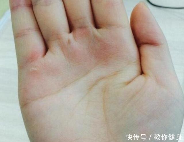 手相三角纹若出现生命线上,心不好,财不顺,命不长