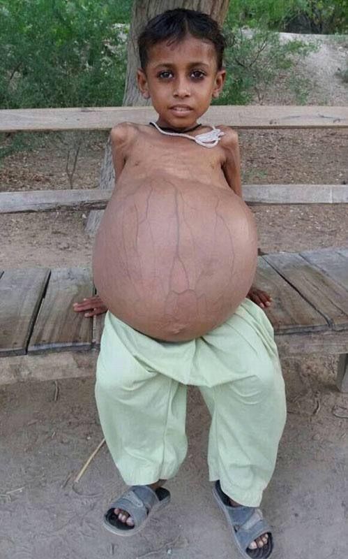 梦见抱着小男孩在笑什么意思 梦见抱着小男孩对我笑梦见长一口牙齿图片