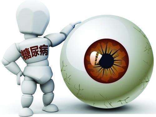 糖尿病患者如何有效预防白内障?邯郸爱眼医生告诉您