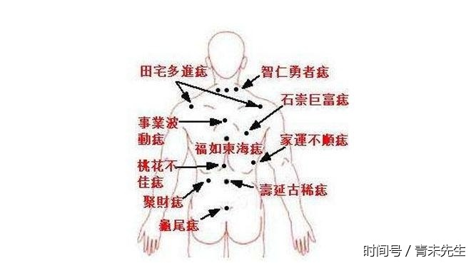 身上有这几颗发财痣,一生财源滚滚