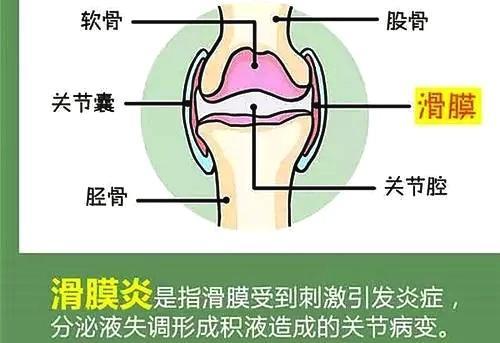 用"它"泡脚,不知不觉膝盖积液消了,滑膜炎一去不复返