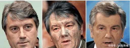 乌克兰前总统尤先科的脸为什么中毒了?