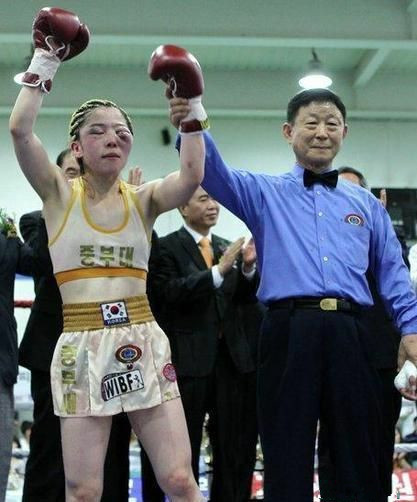 最后赢得了比赛，但却伤痕累累，面部肿成了猪头样。