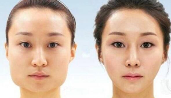 直击:6位韩国人整容前后的对比照,前后简直判若两人!