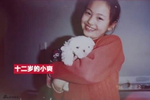 郑爽从小牙齿不齐戴牙套,娜扎气质高冷,张翰一