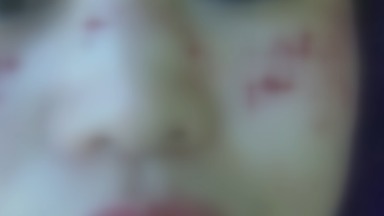 女子激光祛斑结果面瘫了 整形医院:感冒造成的 女子激光祛斑结果面瘫了 整形医院:感冒造成的