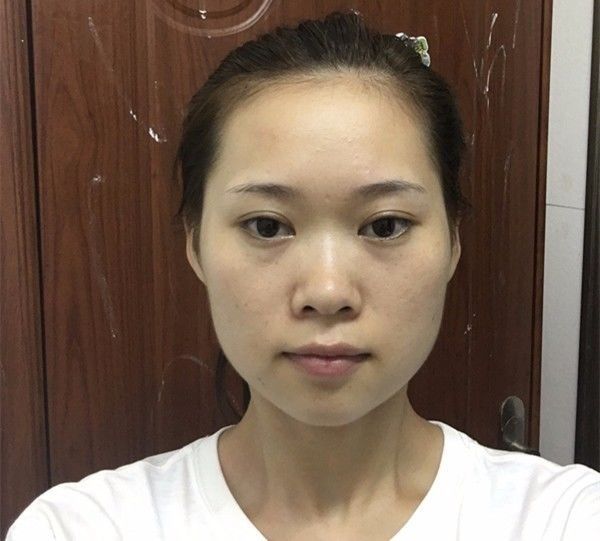 杨幂视频变脸,难道是切下颌骨后遗症?