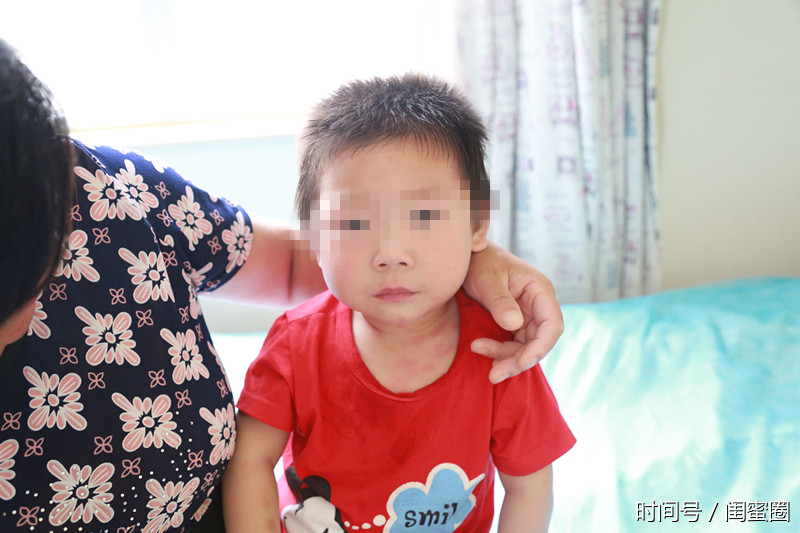 北京天使儿童医院外科专家--庞军良主任!