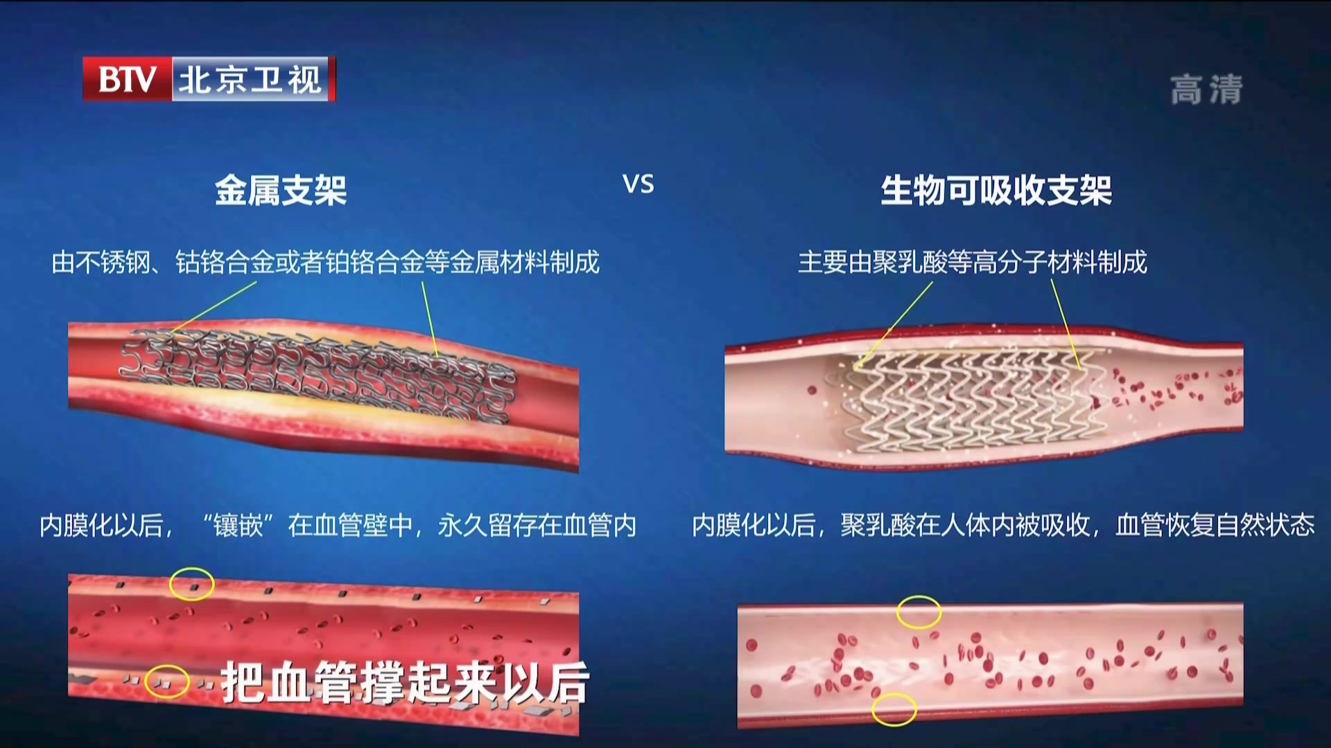 《我要当医生》20210103小支架大心事 《我要当医生》20210103小支架大心事