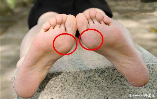 很多人误以为,前掌先着地等于是只能用前脚掌落地,所以刻意不让脚跟