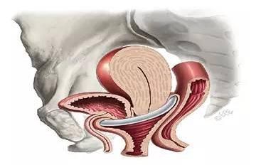盆腔臟器脫垂,大小便控制障礙的情況就更加明顯,產後陰道壁膨出,如果