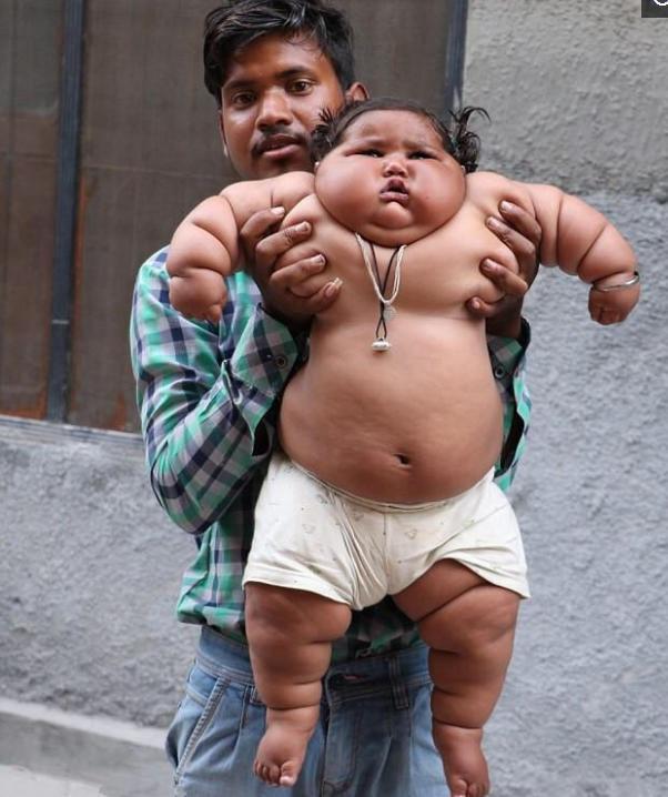 印度巨胖女童 一岁的她快要吃穷父母 网友：父亲对她又爱又怕