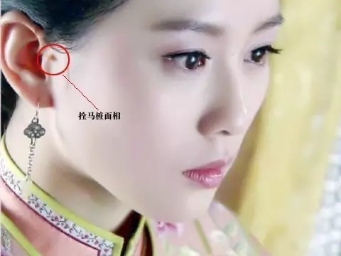 为什么宝宝耳朵上有小孔?邯郸爱眼耳鼻喉专家