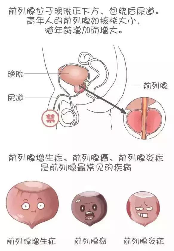 前列腺的小秘密,檔案的小秘密你都知道嗎?