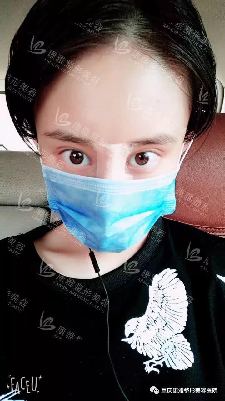 还在纠结做哪款鼻子好看?听处女座小姐姐的准