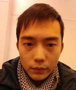 脸上这些痣,是不能点的,点一个后悔一辈子!