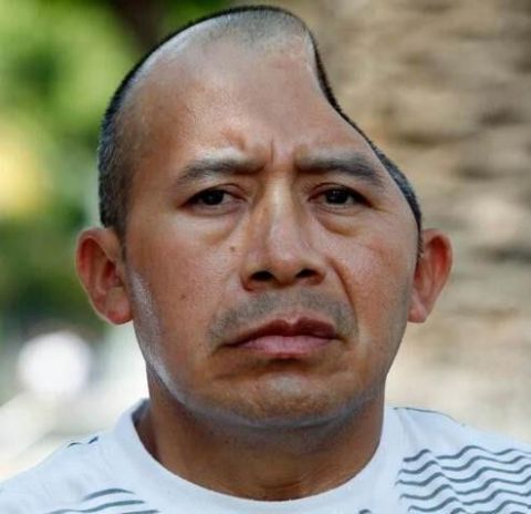 大叔脑袋被打没一半 却意外获得了5800万美金 大叔脑袋被打没一半 却意外获得了5800万美金