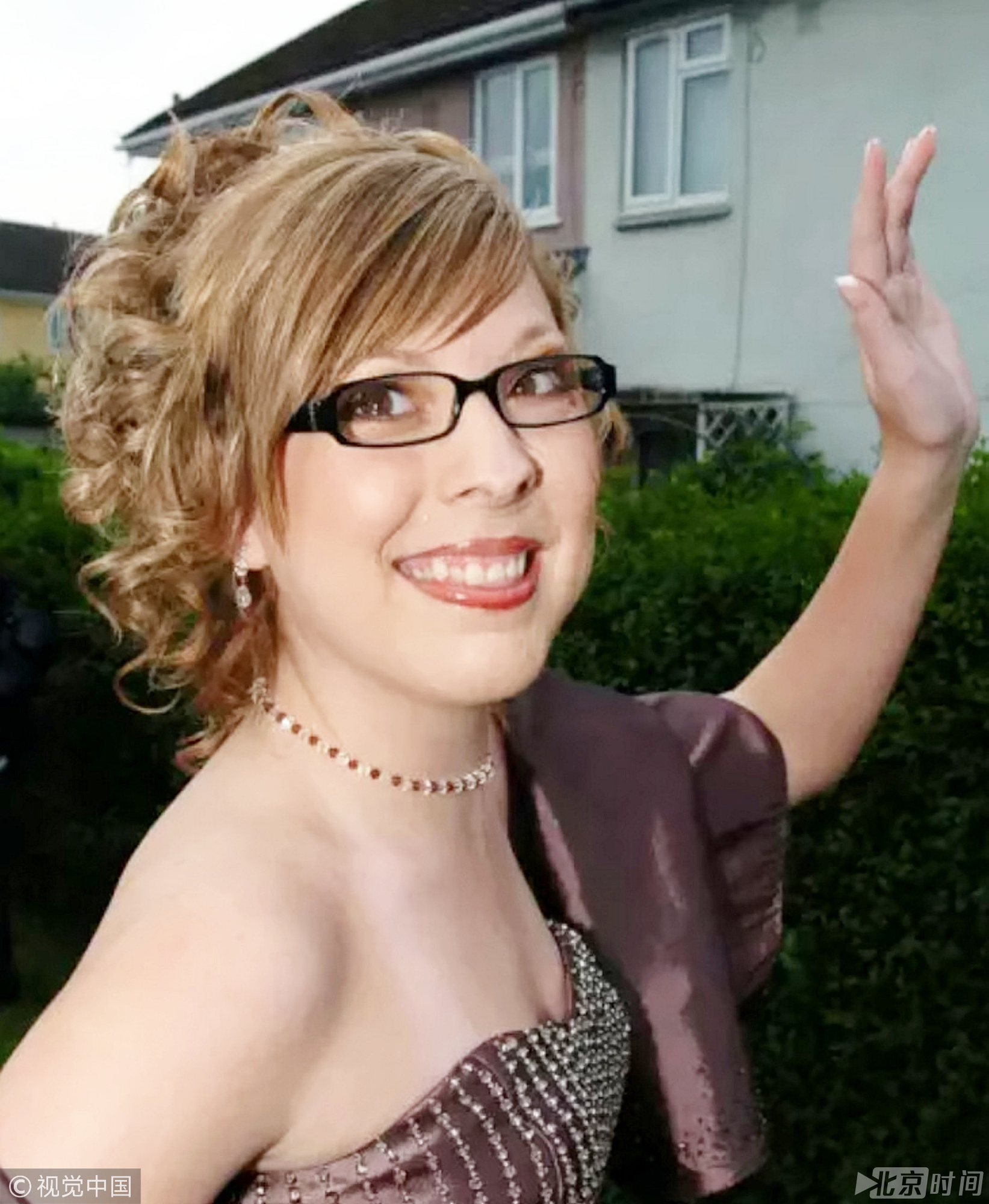 女子出生时面部畸形 经历18次手术收获爱情