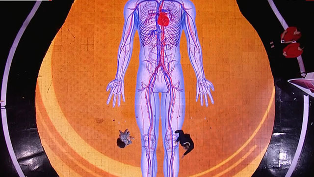 《养生堂》20180202警惕沉默的杀手——肺栓塞 《养生堂》20180202警惕沉默的杀手——肺栓塞