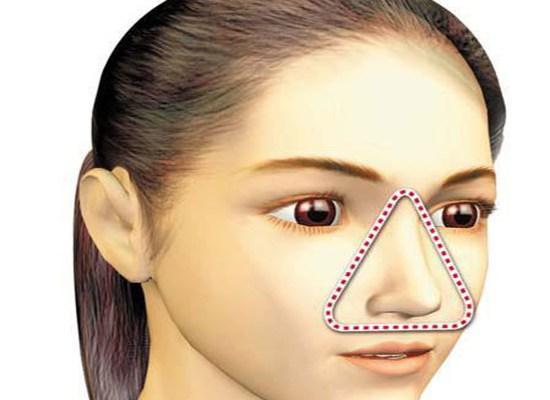 面部危险三角区的痘痘,不要手贱挤,会致命!
