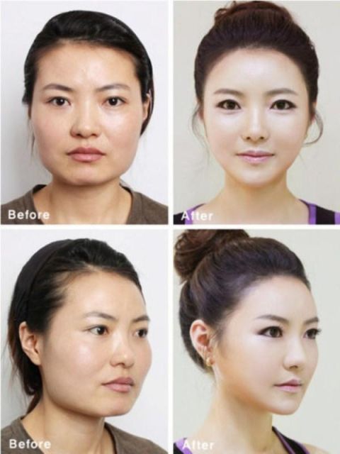 实拍:韩国人整容前后的对比照,丑男变帅男,丑女