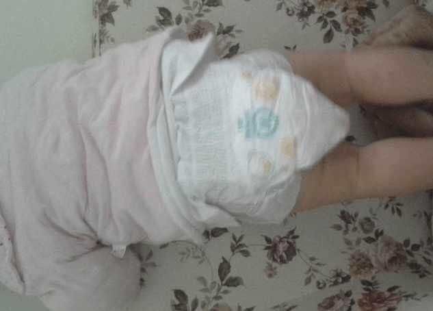 4岁儿童因误服这玩意脸色苍白冒汗抽搐, 家长