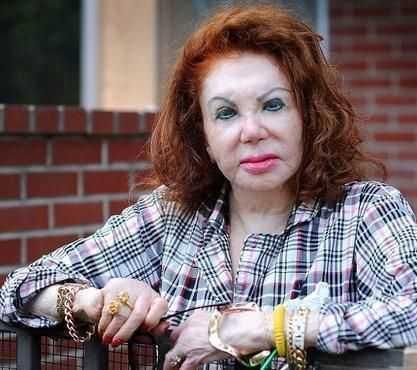 她们整容成芭比娃娃,老了以后变成了老妖怪!