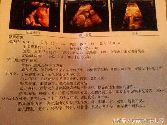四维彩超真能看胎儿性别,排查畸形?这些秘密医
