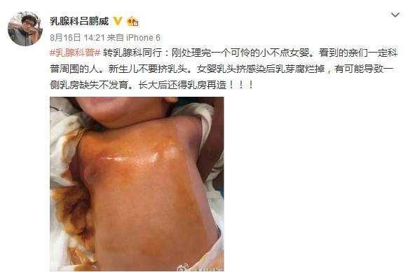 奶奶带婴儿洗澡,宝妈大哭"乳头都挤掉了,你怎么下的去手?