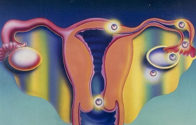 备孕三年,输卵管造影后成功好孕!