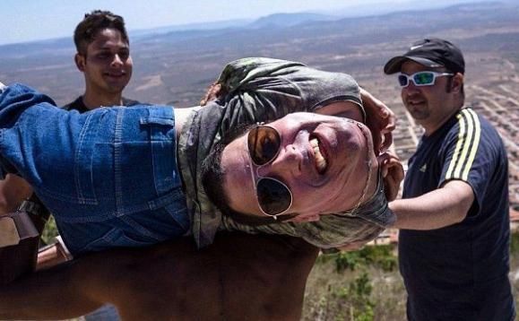 男子先天性畸形!医生建议安乐死!长大后的成就