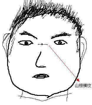 鼻梁还能够看出一个人的意志力和坚毅水平,假如山根上有一条横纹,则