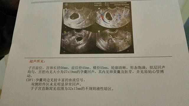 经验分享:什么是宫角妊娠?备孕期应该注意哪些