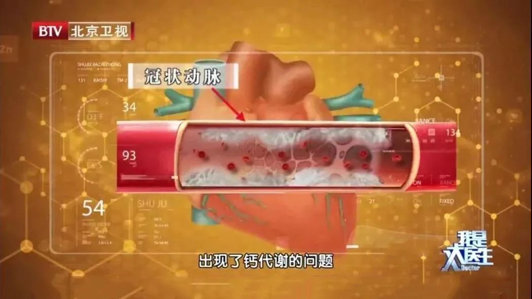 身体里的钙跑错了地方，可能让血管变硬、肝胆结石、关节疼痛！ 