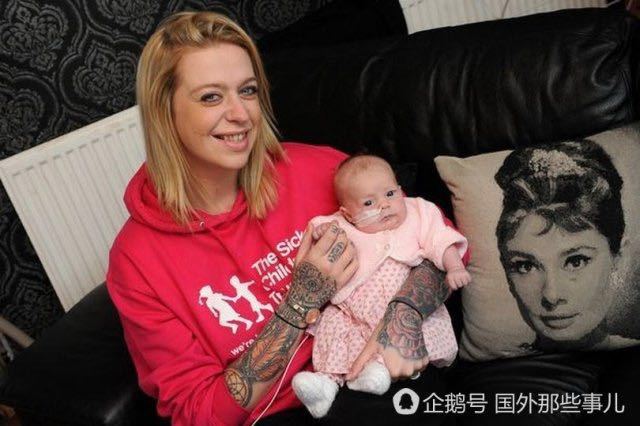 女婴出生时仅有半颗心 手术后奇迹存活