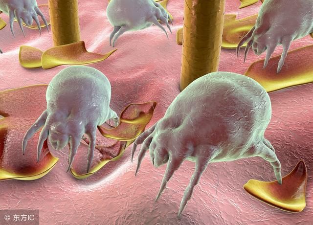 脸上不停的长痘是怎么了?皮肤科:要怪就怪自己