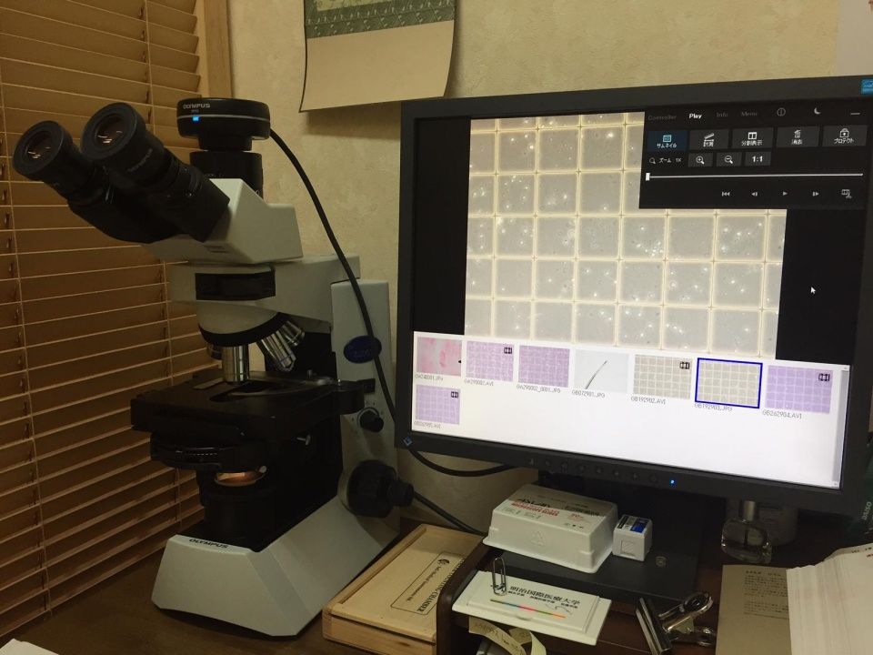 2018年试管婴儿新政策,不需再排队?冷冻卵子