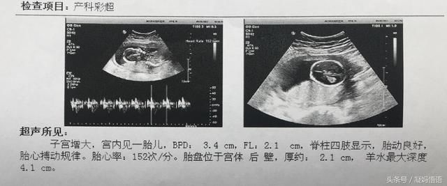 6次孕期彩超数据分析:双顶径、股骨长、胎心率