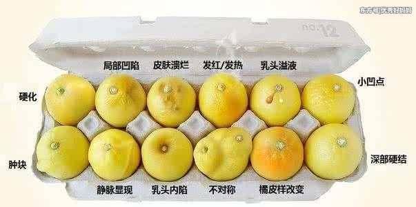 有四种癌症需要体检筛查, 早期一旦查出来相当