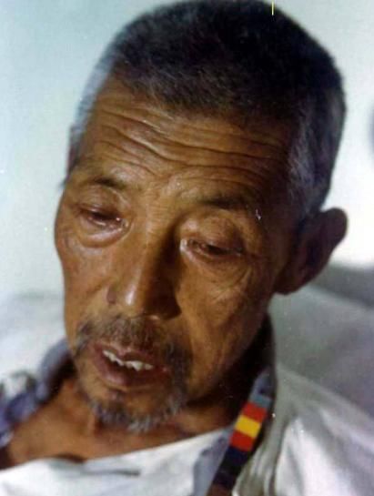 医生提醒:如果这些症状都没有,恭喜你,你的肝脏健康指数非常高!