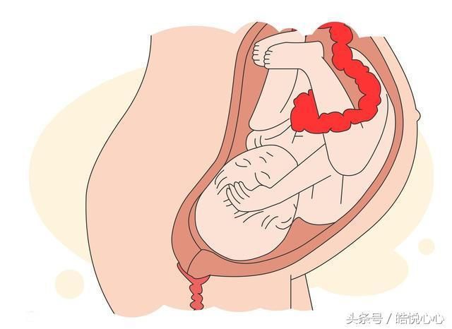 胎儿入盆有什么感觉?关于入盆,准妈妈要知道这