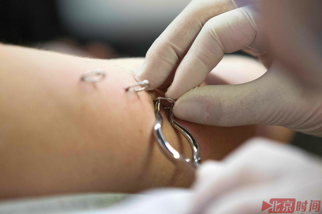 许多年轻人痴迷于穿刺艺术。